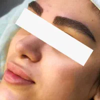 جشنواره کاشت ابرو به روش جراحی و غیر جراحی