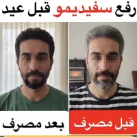 پک درمان رفع سفیدی مو ازریشه باضمانت ماندگاری۳ساله