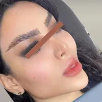غبغب بلفارو ژل بوتاکس پیکرتراشی
