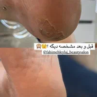 جهت تکمیل آلبوم|خدمات آرایشگری و زیبایی|رشت, گلباغ نماز|دیوار