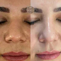تنها یک جلسه با نصف قیمت