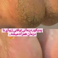 تخفیف ویژه پدیکور و کفسابی