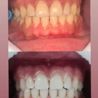 دندانپزشکی هرا ویزیت مشاوره رایگان|خدمات آرایشگری و زیبایی|اندیشه, اندیشه فاز ۳|دیوار