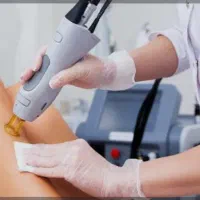 استخدام اپراتور لیزر