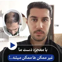 کاشت مو طبیعی شیراز|خدمات آرایشگری و زیبایی|شیراز, قصرالدشت|دیوار