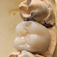 لابراتوار پروتزهای دندانی ثابت|پزشکی|نسیمشهر, |دیوار