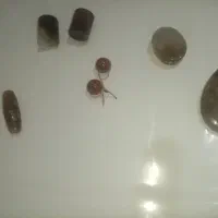 مهره سنگ
