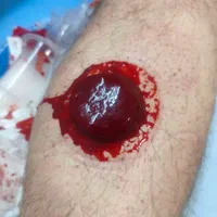 سه سوته حجامت یاد بگیر با مدرک معتبر
