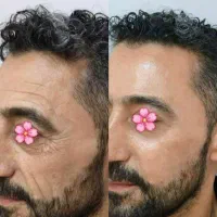 کلاژن هیدرولیز شده شارژ شد