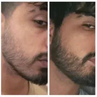 ریشاتو مث آب خوردن در میارم