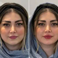 تخفیفات یلدایی ،مدل رایگان ،کلینیک دارای ۳شعبه|خدمات آرایشگری و زیبایی|شهریار, شهرک بهاران (ویره)|دیوار