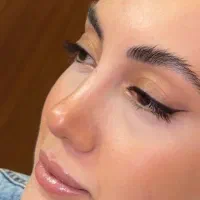 تخفیف عمل و جراحی بینی لیفت صورت ابدو لیپو ساکشن|خدمات آرایشگری و زیبایی|تهران, حصار بوعلی|دیوار