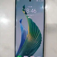 گوشی آنر x9a) honor)|موبایل|تهران, تهرانسر شرقی|دیوار