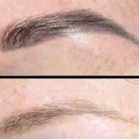 پاککردن تتوی بدن و روشن شدن بیکینی و زیربغل وصورت