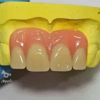 پروتز دندان دندانسازی تضمینی|آرایشی، بهداشتی، درمانی|صفادشت, |دیوار