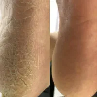 خدمات پدیکور و مانیکور و کاشت ناخن