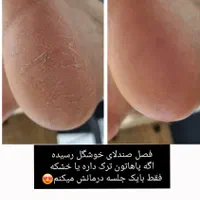 پدیکور و کف سابی|خدمات آرایشگری و زیبایی|رشت, بوسار|دیوار