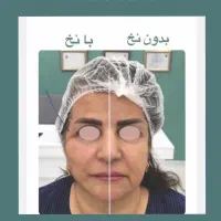 خالبرداری،حذف تاتو با لیزر و تمامی تزریقات زیبایی|خدمات آرایشگری و زیبایی|شیراز, گلدشت معالی‌آباد|دیوار