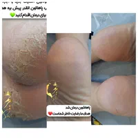آموزش پیشرفته پدیکوروکفسابی|خدمات آموزشی|قم, آزادگان|دیوار