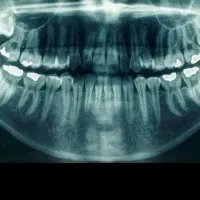 خدمات دندانپزشکی باقیمت مناسب + عکس دندان