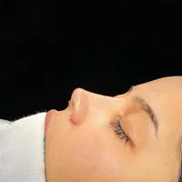 عمل جراحی زیبایی بینی،لیفت صورت،گوش