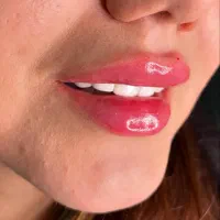 تزریق فیلر و کاشت ناخن|خدمات آرایشگری و زیبایی|خواف, |دیوار