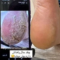 ژلیش پا فقط ۱۵۰