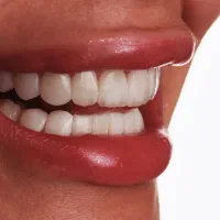 دندان پزشکی ،دندان سازی،کامپوزیت