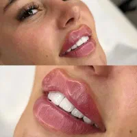 پزشک عمومی زیبایی