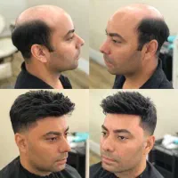 تعویض چسب،خدمات پروتزمودر منزل و محل کارشما|خدمات آرایشگری و زیبایی|تهران, فلسطین (میدان انقلاب)|دیوار