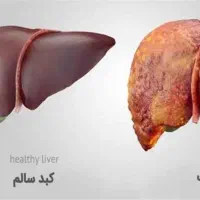 بهبود کبد چرب با پاکسازی بدن