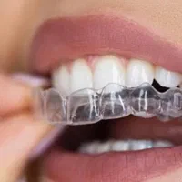 ارتودنسی نامرئی بدون سیم بدون درد - رایگان|خدمات آرایشگری و زیبایی|شیراز, نیایش|دیوار