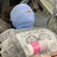 فیشیال تخصصی با پشتیبانی نامحدود