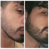ریشت رو به بهترین ورژنش تبدیل کن