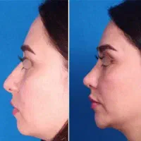 وام فوری زیبایی بدون ضامن  اقساطی