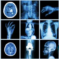 عکس رادیولوژی