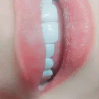 dtal|خدمات آرایشگری و زیبایی|جوانرود, |دیوار