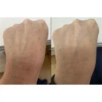 روشن شدن صورت و بدن تضمینی