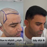 کاشتمو شیراز با شرایط اقساط|خدمات آرایشگری و زیبایی|شیراز, تلخ داش|دیوار