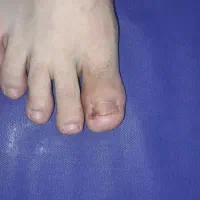 تزریقات و سرم و پانسمان در منزل با قیمت درمانگاه