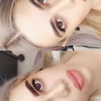 فیبروز ابرو (بدون نیاز به ترمیم)