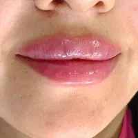 آموزش صفر تا صد پزشک زیبایی