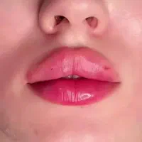 فیلر ژل لب تخصصی بوتاکس پزشک کلینیک زیبایی|خدمات آرایشگری و زیبایی|تهران, تهرانسر مرکزی|دیوار