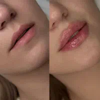 کلینیک تخصصی ژل و فیلر،لیپو و..|خدمات آرایشگری و زیبایی|شهریار, شهریار|دیوار