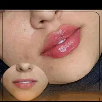 خدمات ژل وبوتاکس /کاشت مووابرو/باکمترین قیمت|خدمات آرایشگری و زیبایی|خرم‌آباد, |دیوار