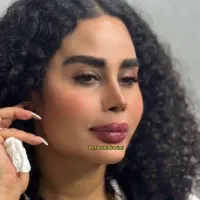 ژل و بوتاکس کلینیک زیبایی دکترفرشیدکریمی