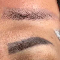 ریموو تخصصی تتو