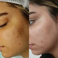 خدمات پوست ومو