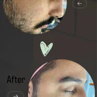 فیشال تخصصی،پاکسازی در مطب پزشک (خانم‌هاوآقایان)|خدمات آرایشگری و زیبایی|اهواز, کیانپارس |دیوار