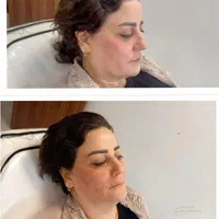 کلینیک پوست مو و زیبایی آراد سهروردی شمالی|خدمات آرایشگری و زیبایی|تهران, سهروردی|دیوار